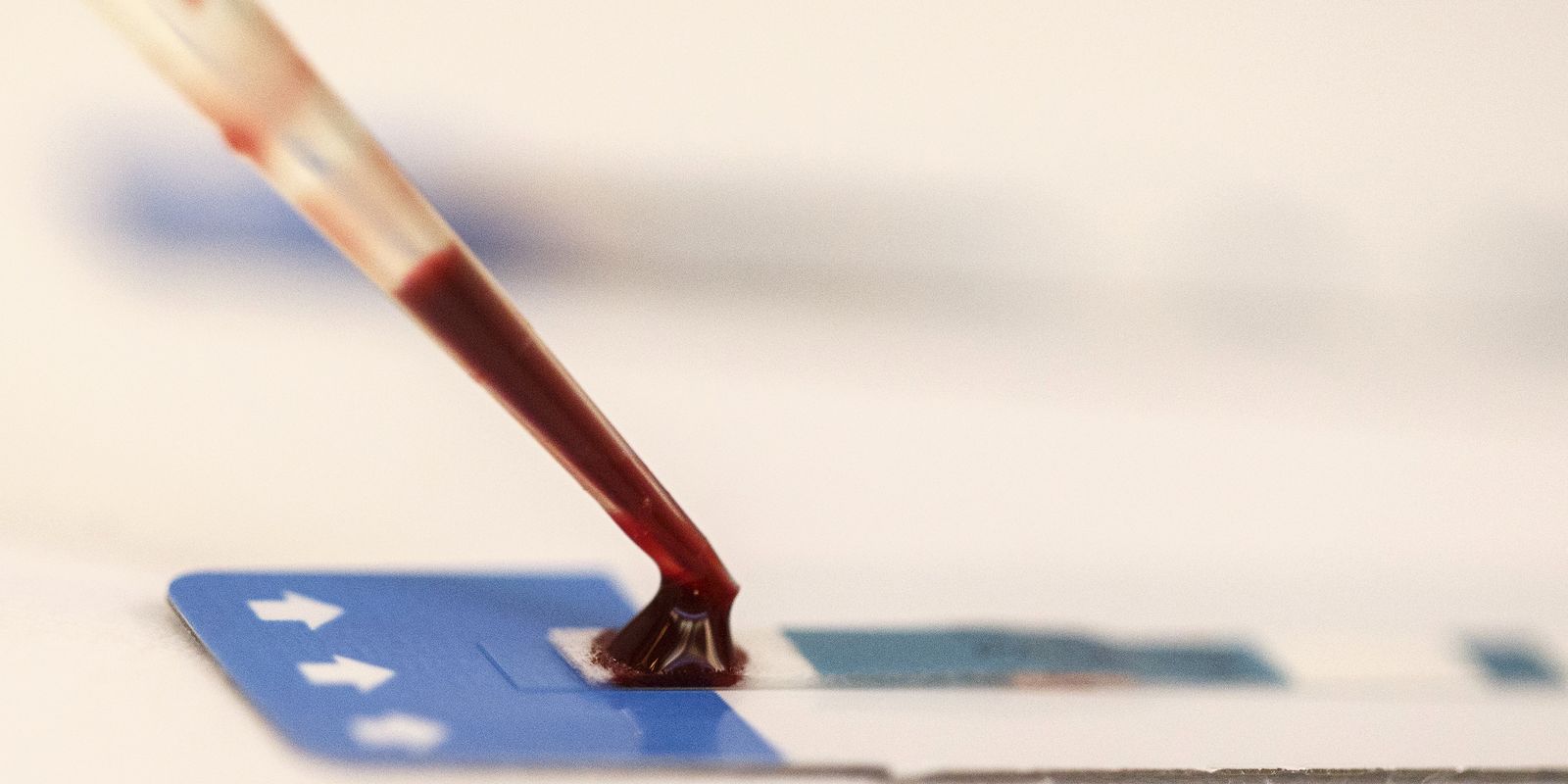 Unesco: maioria de jovens com HIV aprova acolhida em serviços de saúde