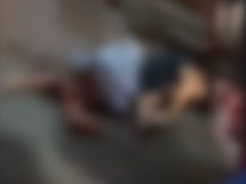 Mulher tem osso exposto após acidente em Manacapuru