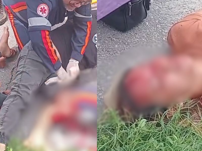 Vídeo chocante mostra vítimas com cabeça rachada e perna esmagada em acidente